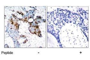 Image no. 1 for anti-Estrogen Receptor 1 (ESR1) (Ser118) antibody (ABIN197218) (Estrogen Receptor alpha Antikörper  (Ser118))