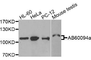 Western blot analysis of extracts of various cells, using ADAMTS5 antibody. (ADAMTS5 Antikörper)