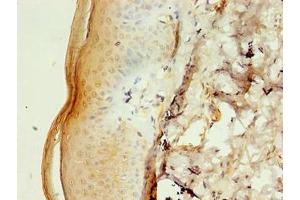 Immunohistochemistry of paraffin-embedded human skin tissue using ABIN7146503 at dilution of 1:100