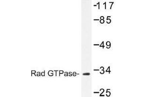 Image no. 1 for anti-RAS (RAD and GEM)-Like GTP-Binding 1 (REM1) antibody (ABIN317842) (REM1 Antikörper)