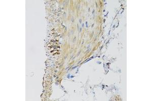Immunohistochemistry of paraffin-embedded mouse stomach using DGUOK antibody (ABIN2562205) at dilution of 1:100 (40x lens). (Deoxyguanosine Kinase Antikörper)