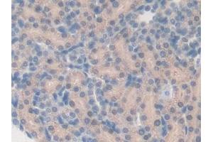 Immunohistochemistry (IHC) image for anti-Cytochrome P450, Family 27, Subfamily B, Polypeptide 1 (CYP27B1) (AA 251-500) antibody (ABIN7442240)