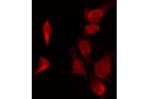 ABIN6272357 staining HepG2 by IF/ICC. (NEK9 Antikörper  (Internal Region))