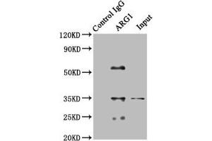 Immunoprecipitating SOD1 in HEK293 whole cell lysate Lane 1: Rabbit control IgG (1 μg) instead of ABIN7144580 in HEK293 whole cell lysate. (Liver Arginase Antikörper  (AA 1-322))