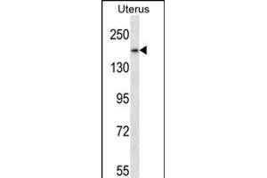 SMC1B Antibody (Center) (ABIN657773 and ABIN2846748) western blot analysis in human normal Uterus tissue lysates (35 μg/lane). (SMC1B Antikörper  (AA 737-765))