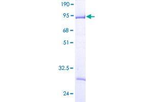 CD2BP2 Protein (AA 1-341) (GST tag)