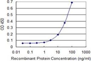 Detection limit for recombinant GST tagged ZKSCAN5 is 1 ng/ml as a capture antibody. (ZKSCAN5 Antikörper  (AA 1-839))