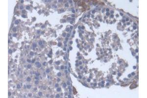 DAB staining on IHC-P; Samples: Mouse Testis Tissue (CYP17A1 Antikörper  (AA 201-507))