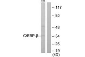 Western blot analysis of extracts from NIH-3T3 cells, using C/EBP-beta (Ab-235/188) Antibody. (CEBPB Antikörper  (AA 201-250))