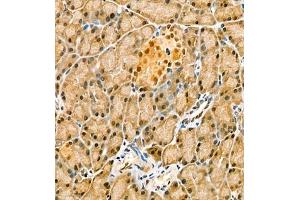 Immunohistochemistry (Paraffin-embedded Sections) (IHC (p)) image for anti-Cbp/p300-Interacting Transactivator, with Glu/Asp-Rich Carboxy-terminal Domain, 4 (CITED4) antibody (ABIN7073356)