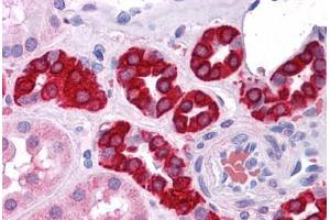 Human Kidney: Formalin-Fixed, Paraffin-Embedded (FFPE) (AGR3 Antikörper)