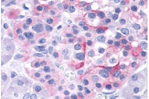 Anti-TRPV4 antibody  ABIN1049441 IHC staining of human pancreas, islet. (TRPV4 Antikörper  (Internal Region))