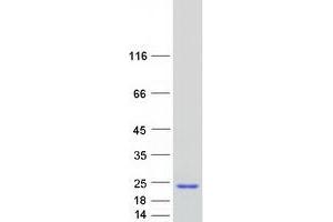 NUDT11 Protein (Myc-DYKDDDDK Tag)