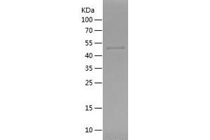 RPS6KA2 Protein (AA 66-311) (His-IF2DI Tag)