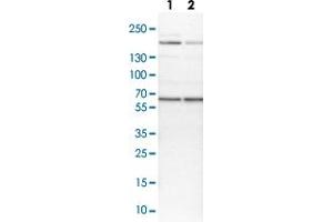Western blot analysis of Lane 1: NIH-3T3 cell lysate (Mouse embryonic fibroblast cells) Lane 2: NBT-II cell lysate (Rat Wistar bladder tumour cells) with USP14 polyclonal antibody  at 1:100-1:250 dilution.