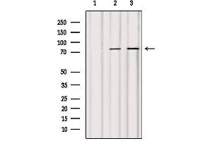 Western blot analysis of extracts from various samples, using ACSL4/FACL4 Antibody. (ACSL4 Antikörper  (N-Term))