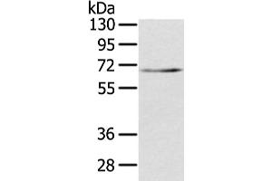 Western Blotting (WB) image for anti-Transducin (Beta)-Like 1X-Linked (TBL1X) antibody (ABIN5961943) (TBL1X Antikörper)