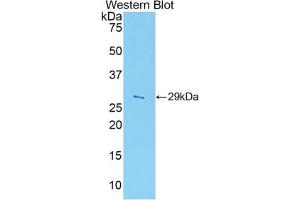 Western blot analysis of the recombinant protein. (ADAM5 Antikörper  (AA 413-649))