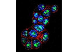 Confocal immunofluorescent analysis of PYGO1 Antibody (C-term) (ABIN656121 and ABIN2845460) with ZR-75-1 cell followed by Alexa Fluor 488-conjugated goat anti-rabbit lgG (green). (PYGO1 Antikörper  (C-Term))