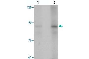 Western blot analysis of AFAP1 in HeLa cell lysate with AFAP1 polyclonal antibody  at (lane 1) 1 and (lane 2) 2 ug/mL. (AFAP Antikörper  (N-Term))