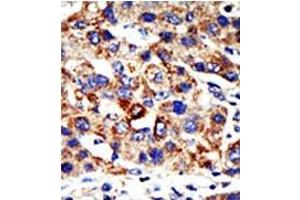 Image no. 1 for anti-Histone Deacetylase 8 (HDAC8) (N-Term) antibody (ABIN356653) (HDAC8 Antikörper  (N-Term))