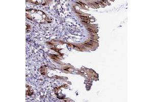 Immunohistochemical staining of human rectum with MUC13 polyclonal antibody  shows strong cytoplasmic positivity in goblet cells. (MUC13 Antikörper)
