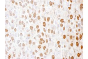 Immunohistochemistry (IHC) image for anti-Sjogren Syndrome Antigen B (SSB) (AA 50-100) antibody (ABIN7454499)