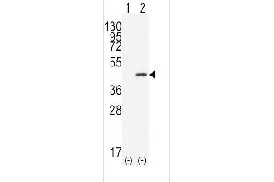 Western blot analysis of CDX2(arrow) using rabbit polyclonal CDX2 Antibody (N-term) (ABIN390076 and ABIN2840597). (CDX2 Antikörper  (N-Term))