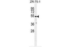 TBB1 Antibody (N-term) western blot analysis in ZR-75-1 cell line lysates (35µg/lane). (TUBB1 Antikörper  (N-Term))
