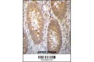 DHRS7B Antibody immunohistochemistry analysis in formalin fixed and paraffin embedded human colon tissue followed by peroxidase conjugation of the secondary antibody and DAB staining. (DHRS7B Antikörper  (AA 133-161))