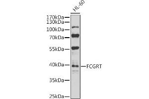 Western blot analysis of extracts of HL-60 cells, using FCGRT antibody (ABIN6127922, ABIN6140552, ABIN6140553 and ABIN6224639) at 1:1000 dilution. (FcRn Antikörper  (AA 25-300))