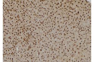 ABIN6257992 and ABIN6275831 at 1/100 staining Rat liver tissue by IHC-P. (TRAF2 Antikörper  (C-Term))