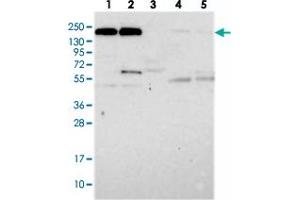 Western blot analysis of Lane 1: RT-4, Lane 2: U-251 MG, Lane 3: Human Plasma, Lane 4: Liver, Lane 5: Tonsil with DOCK3 polyclonal antibody  at 1:250-1:500 dilution. (DOCK3 Antikörper)