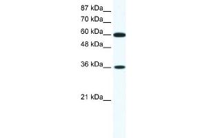 WB Suggested Anti-FOXF1 Antibody Titration: 1. (FOXF1 Antikörper  (N-Term))