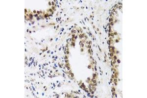 Immunohistochemistry of paraffin-embedded human prostate using SAFB2 antibody. (SAFB2 Antikörper  (AA 1-255))