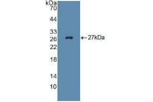 Detection of Recombinant FBN1, Mouse using Polyclonal Antibody to Fibrillin 1 (FBN1) (Fibrillin 1 Antikörper  (AA 959-1145))