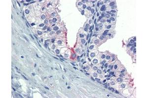 AMH antibody was used for immunohistochemistry at a concentration of 4-8 ug/ml. (AMH Antikörper  (Middle Region))