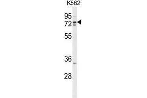 Western blot analysis of ZRANB1 Antibody (C-term) in K562 cell line lysates (35 µg/lane). (ZRANB1 Antikörper  (C-Term))