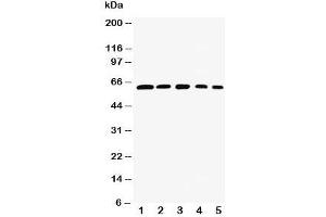 Western blot testing of RelB antibody and Lane 1:  rat testis;  2: (h) HeLa;  3: (m) NIH3T3;  4: (h) Raji;  5: (m) HEPA cell lysate. (RELB Antikörper  (AA 393-413))
