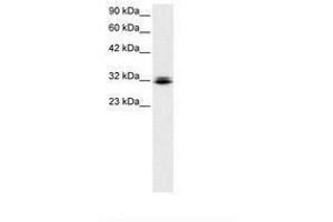 Image no. 1 for anti-Retina and Anterior Neural Fold Homeobox (RAX) (N-Term) antibody (ABIN6735790) (RAX Antikörper  (N-Term))
