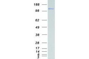 Validation with Western Blot