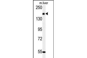 Western blot analysis of KI Antibody (C-term) (ABIN651358 and ABIN2840200) in mouse liver tissue lysates (35 μg/lane). (CCDC180 Antikörper  (C-Term))