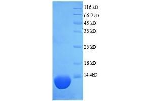 SDS-PAGE (SDS) image for EMI Domain Containing 1 (EMID1) (AA 1-74), (full length) protein (His tag) (ABIN5713298) (EMID1 Protein (AA 1-74, full length) (His tag))