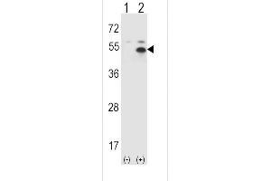 Western blot analysis of STAM using rabbit polyclonal STAM Antibody (P341) using 293 cell lysates (2 ug/lane) either nontransfected (Lane 1) or transiently transfected (Lane 2) with the STAM gene.