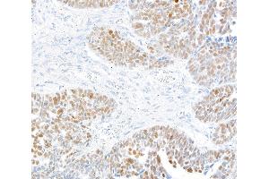 Immunohistochemistry (IHC) image for anti-Kruppel-Like Factor 5 (Intestinal) (KLF5) (AA 325-375) antibody (ABIN7795630)