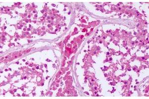 Immunohistochemistry (IHC) image for anti-Protein tyrosine Phosphatase, Receptor Type, E (PTPRE) (Cytoplasmic Domain) antibody (ABIN1049273)