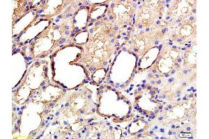 Formalin-fixed and paraffin embedded human kidney labeled with Anti ANGPTL3/ANG5 Polyclonal Antibody, Unconjugated  at 1:200 followed by conjugation to the secondary antibody and DAB staining (ANGPTL3 Antikörper  (AA 21-120))