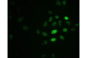 Immunofluorescence staining of Hela cells with ABIN7127742 at 1:100,counter-stained with DAPI. (Rekombinanter RPA2 Antikörper  (pThr21))