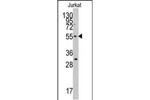 Western blot analysis of TERF1 polyclonal antibody  in Jurkat cell line lysates (35 ug/lane). (TRF1 Antikörper  (C-Term))
