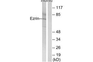 Western blot analysis of extracts from K562 cells, using Ezrin (epitope around residue 478) antibody. (Ezrin Antikörper  (Tyr478))